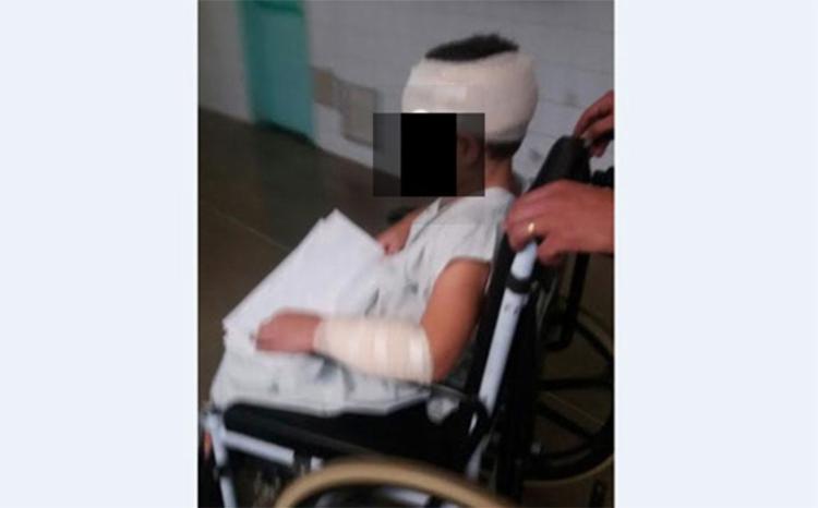 Menino foi atacado no braço, na perna e na cabeça - Foto: Reprodução | Blog Rodrigo Ferraz