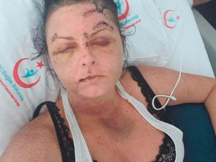 Vítima afirmou que foi atacada enquanto dormia no hotel