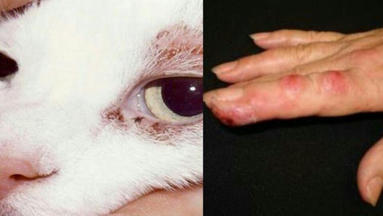   Sporotrichosis is caused by Sporothrix mushrooms, which are found on the ground, wooden barbs, feline nails or mouths (cats) and, among other things, mold. of the genus Sporothrix, found on the ground, wooden barbs, nails or the mouth of felines (cats) and among others - Photo: Reproduction 