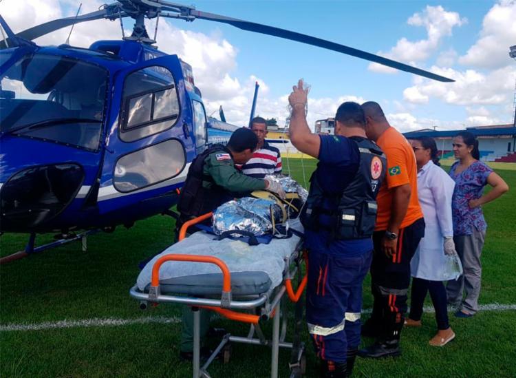 Criança foi vÃtima de acidente doméstico e teve 80% do corpo queimado - Foto: Divulgação | SSP