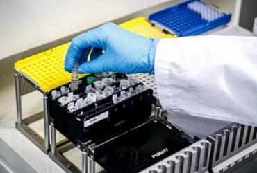 Peru registra primeiro caso confirmado de coronavírus | Rob Engelaar | ANP | AFP