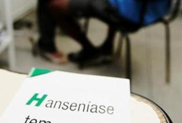 Ministério da Saúde orienta a continuidade do tratamento para hanseníase | 