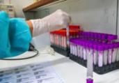 UFRJ desenvolve teste sorológico 20 vezes mais barato | Agência Brasil