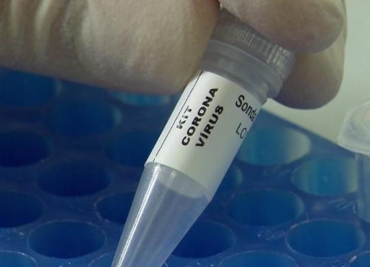 Bahia registra 1.048 casos de Covid-19 nas últimas 24 horas | Reprodução | RPC